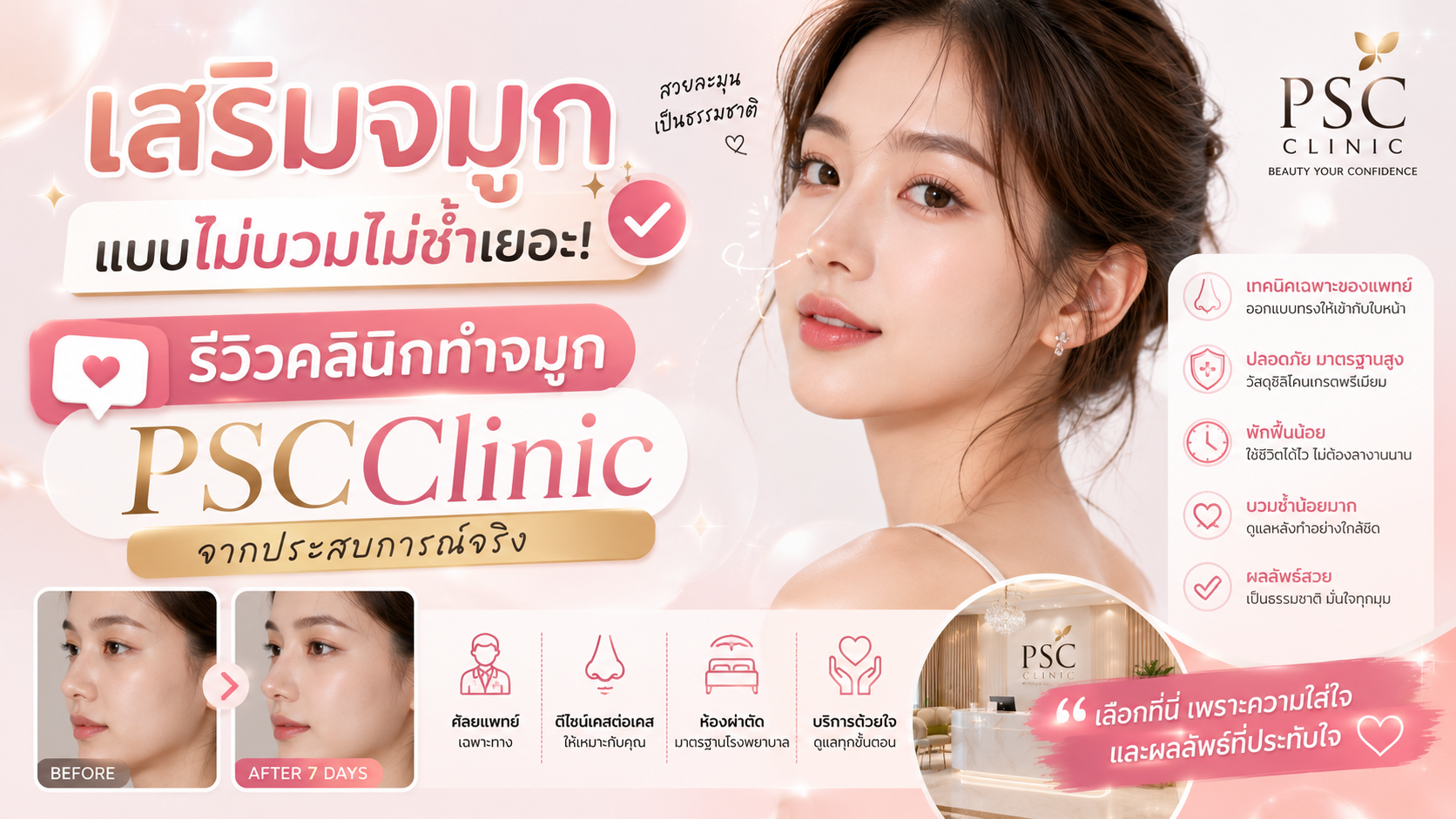 เสริมจมูกแบบไม่บวมไม่ช้ำเยอะ รีวิวคลินิกทำจมูก