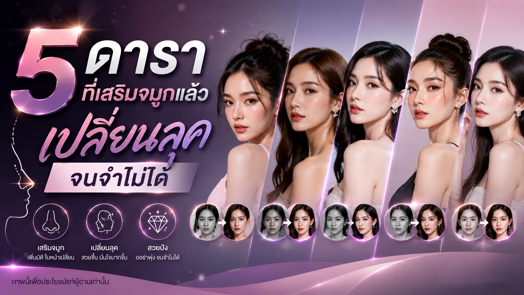 5 ดาราที่เสริมจมูกแล้วเปลี่ยนลุคจนจำไม่ได้